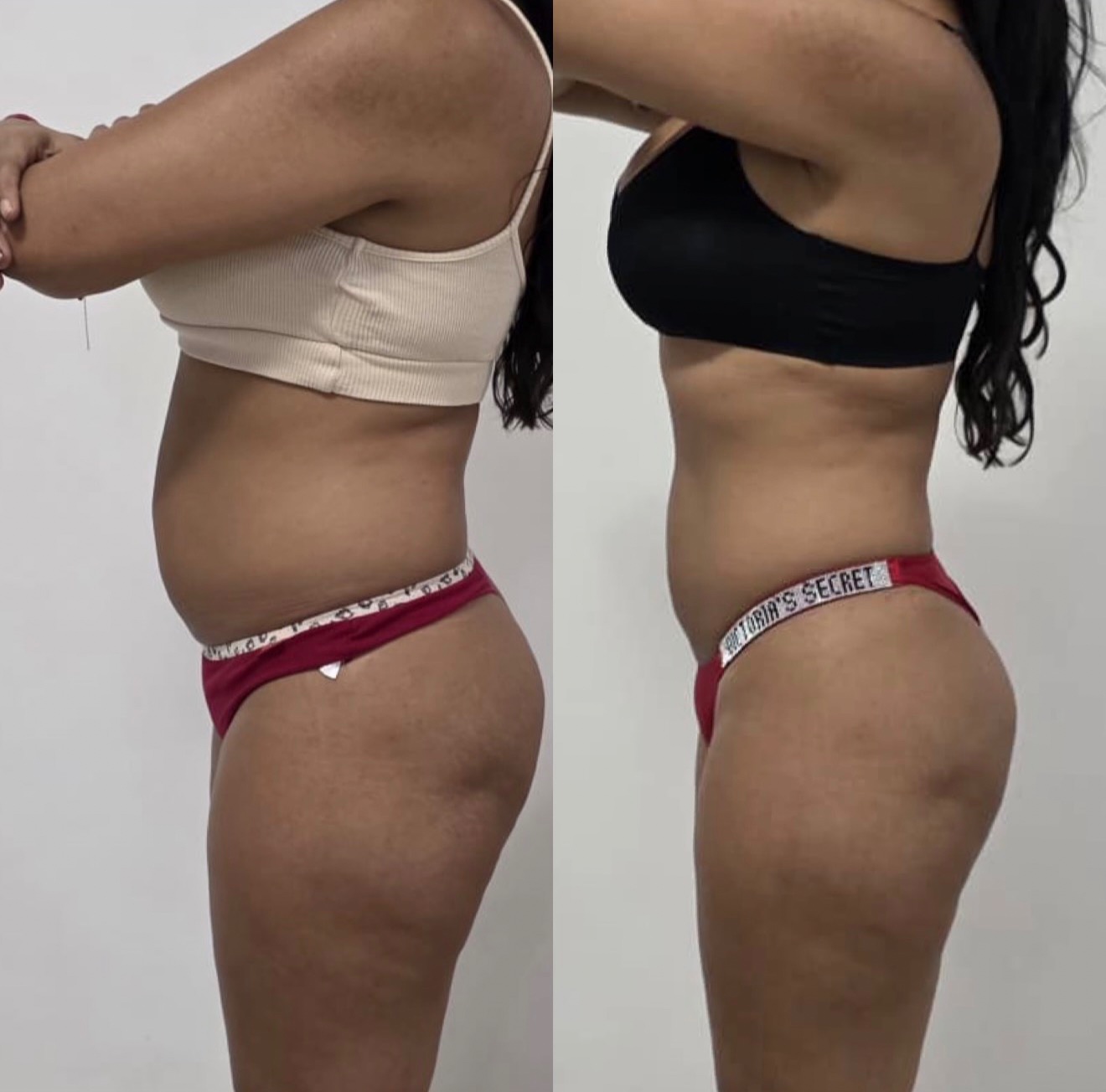 Client transformation before and after